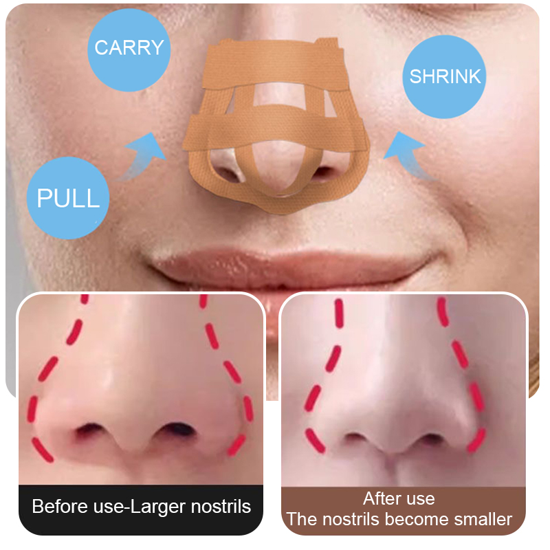 Beauty Nose Up Lifting Bridge  – Nose Trimmer recenzja i cena
